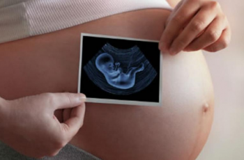 Conheça mais sobre a ultrassonografia obstétrica e seus benefícios