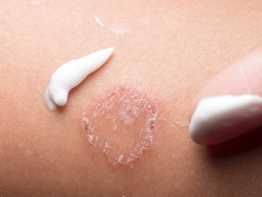 dermatologista-madureira