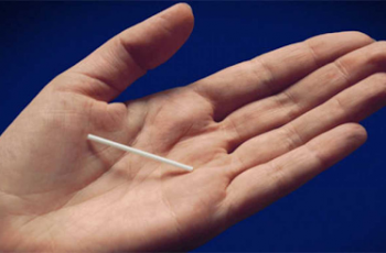 Implanon: 6 vantagens de utilizar